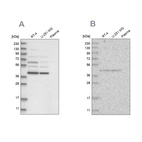 Anti-GPN1 Antibody
